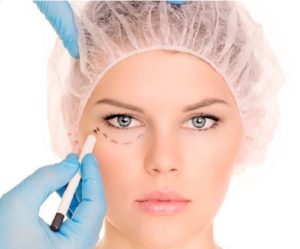 eyelid surgery Colombia