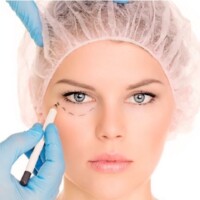 Eyelid surgery eyelid surgery Colombia